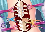 Anna Scoliosis Surgery
