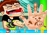 Ben10 Hand Doctor - Free Online Game